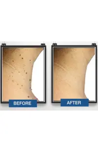 Before & After 2 (1)